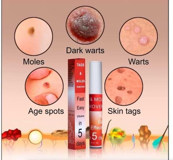 Skin Tags & Moles Remover – Fast, Easy & Effective Formula for All Skin Types (Pack of 2)
