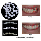CALANDIS® Moldable Teeth Veneers with Adhesive Fitting Beads – Temporary False Teeth Kit