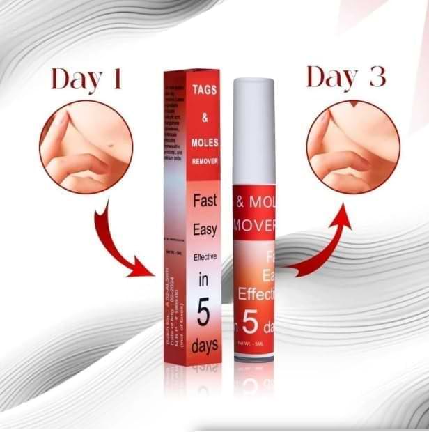 Skin Tags & Moles Remover – Fast, Easy & Effective Formula for All Skin Types (Pack of 2)