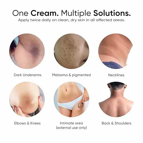 Dark Spot Reduction Cream for Pigmentation, Melasma & Acne Marks with Kojic Acid & Alpha Arbutin – For Men & Women (50g)