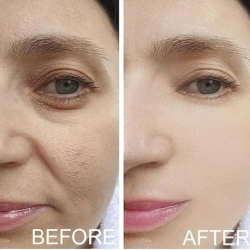 Protein Thread Lifting Kit with Absorbable Collagen – Gold Protein Collagen for Skin Rejuvenation & Tightening (10ml + 20pcs)