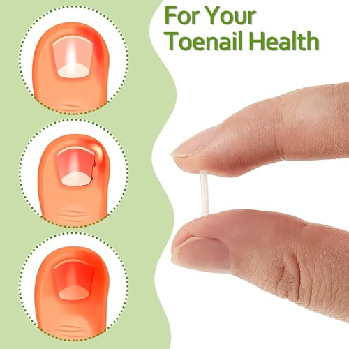 Toenail Corrector Strips – Ingrown Nail Corrector with Gentle Adhesive (50 Pcs Breathable Patches)
