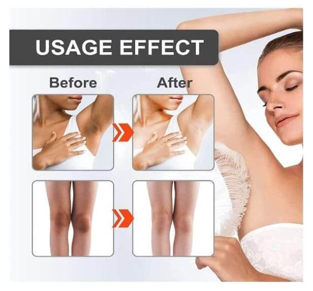 Snow Bleach Body Whitening Cream – Skin Brightening & Even Tone for Men & Women (30ml | JKSE-YT36)